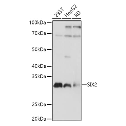 Western Blot - Anti-SIX2 Antibody (A89231) - Antibodies.com