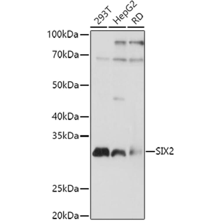 Western Blot - Anti-SIX2 Antibody (A89231) - Antibodies.com