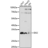 Western Blot - Anti-SIX2 Antibody (A89231) - Antibodies.com