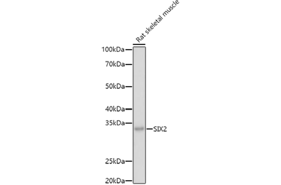 Western Blot - Anti-SIX2 Antibody (A89231) - Antibodies.com