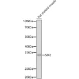 Western Blot - Anti-SIX2 Antibody (A89231) - Antibodies.com