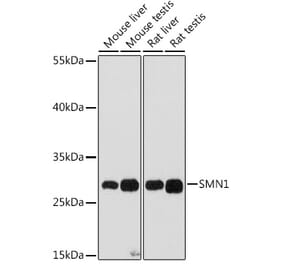 Western Blot - Anti-SMN/Gemin 1 Antibody (A89232) - Antibodies.com