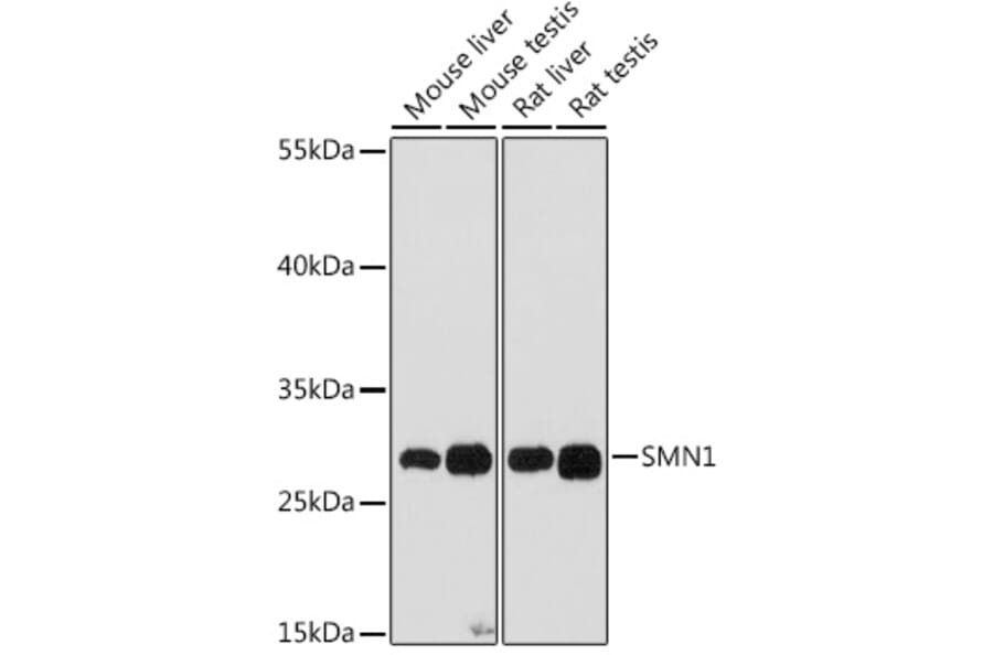 Western Blot - Anti-SMN/Gemin 1 Antibody (A89232) - Antibodies.com