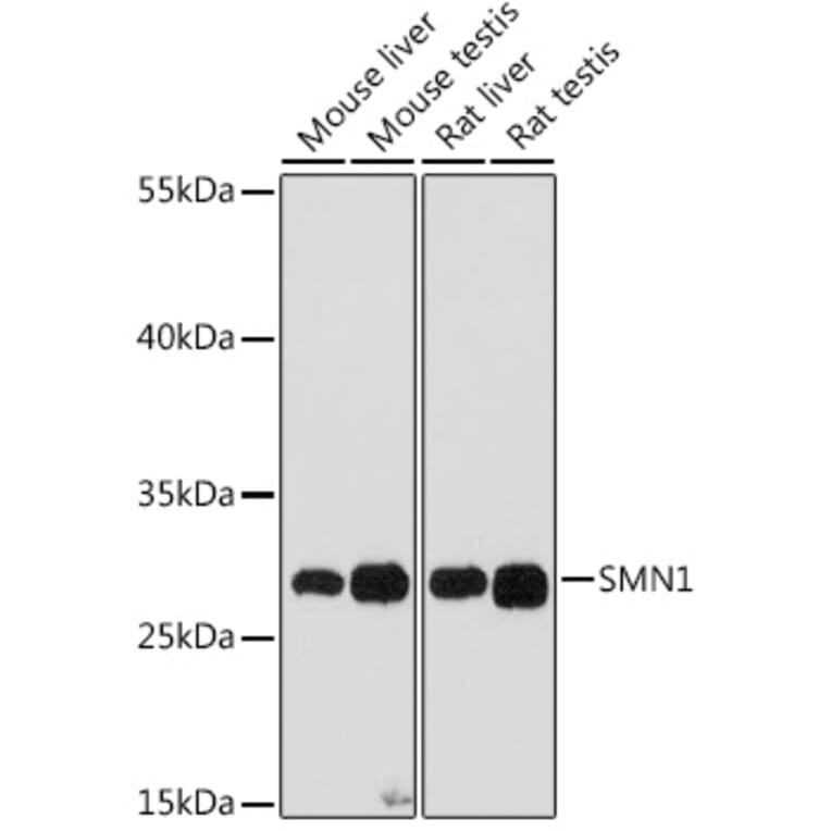 Western Blot - Anti-SMN/Gemin 1 Antibody (A89232) - Antibodies.com