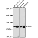 Western Blot - Anti-SMN/Gemin 1 Antibody (A89232) - Antibodies.com