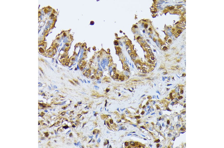 Immunohistochemistry - Anti-SMN/Gemin 1 Antibody (A89232) - Antibodies.com