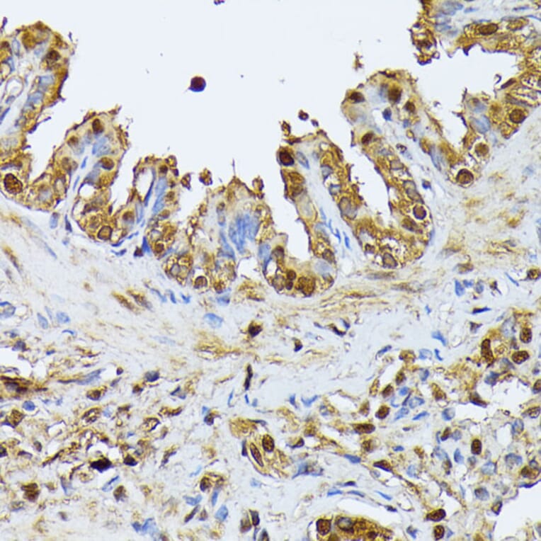 Immunohistochemistry - Anti-SMN/Gemin 1 Antibody (A89232) - Antibodies.com