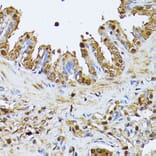 Immunohistochemistry - Anti-SMN/Gemin 1 Antibody (A89232) - Antibodies.com