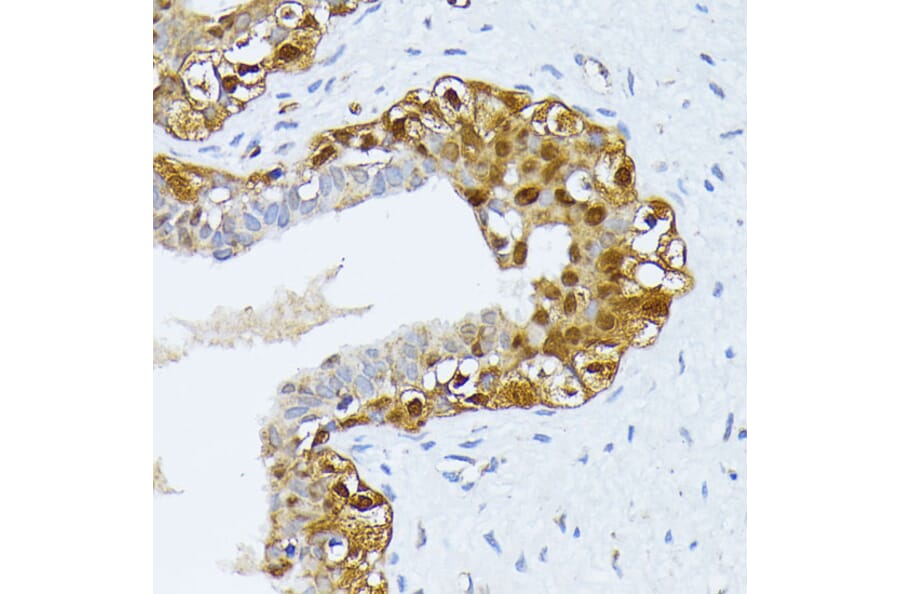 Immunohistochemistry - Anti-SMN/Gemin 1 Antibody (A89232) - Antibodies.com