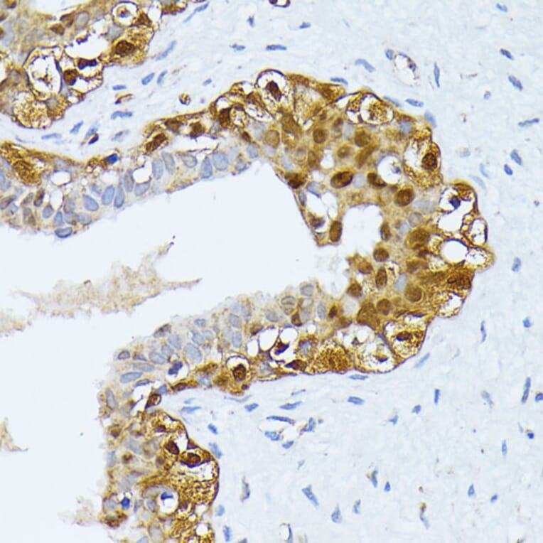 Immunohistochemistry - Anti-SMN/Gemin 1 Antibody (A89232) - Antibodies.com