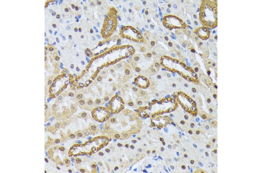 Immunohistochemistry - Anti-SMN/Gemin 1 Antibody (A89232) - Antibodies.com