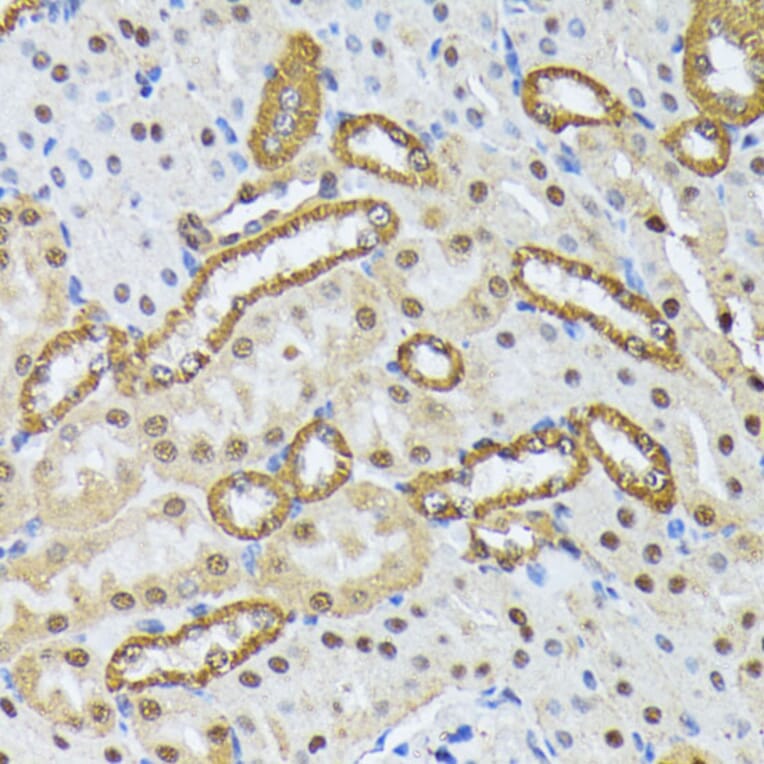 Immunohistochemistry - Anti-SMN/Gemin 1 Antibody (A89232) - Antibodies.com