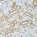 Immunohistochemistry - Anti-SMN/Gemin 1 Antibody (A89232) - Antibodies.com