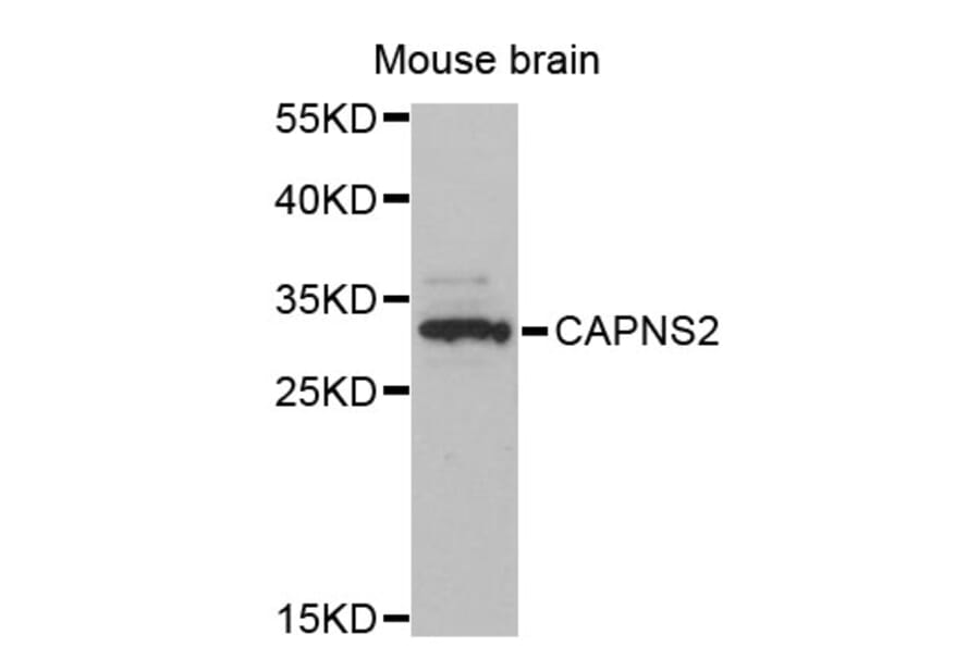 Western Blot - Anti-CAPNS2 Antibody (A12394) - Antibodies.com