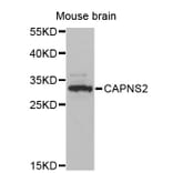 Western Blot - Anti-CAPNS2 Antibody (A12394) - Antibodies.com