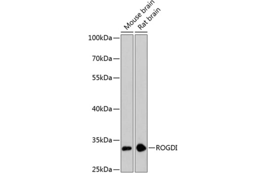 Western Blot - Anti-ROGDI Antibody (A89234) - Antibodies.com