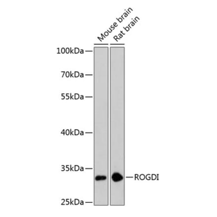 Western Blot - Anti-ROGDI Antibody (A89234) - Antibodies.com