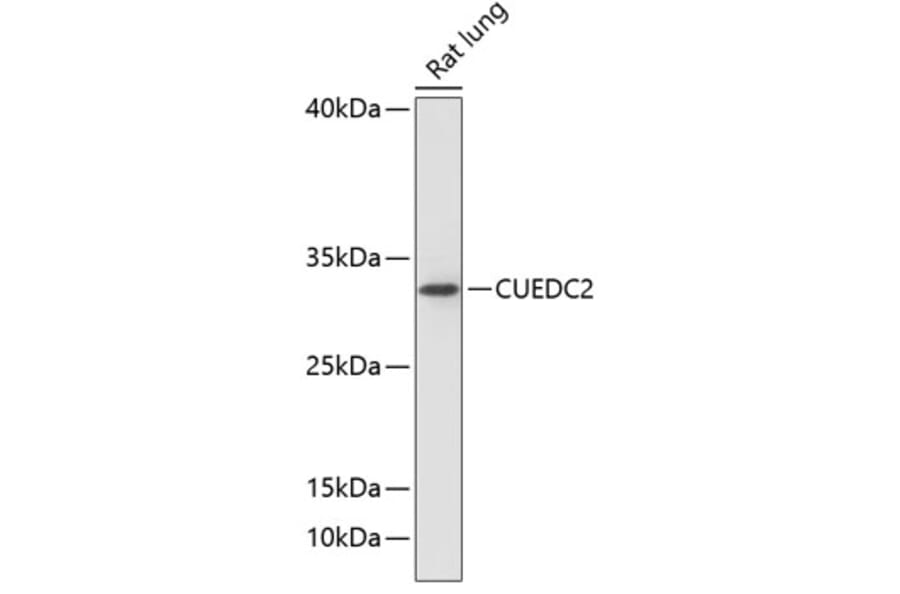 Western Blot - Anti-CUEDC2 Antibody (A89235) - Antibodies.com