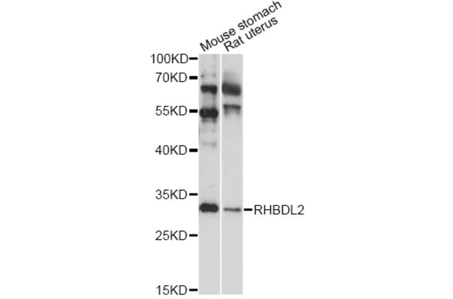Western Blot - Anti-RHBDL2 Antibody (A14407) - Antibodies.com