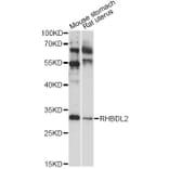 Western Blot - Anti-RHBDL2 Antibody (A14407) - Antibodies.com