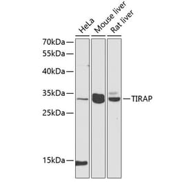 Western Blot - Anti-TIRAP Antibody (A89237) - Antibodies.com