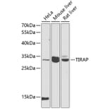 Western Blot - Anti-TIRAP Antibody (A89237) - Antibodies.com