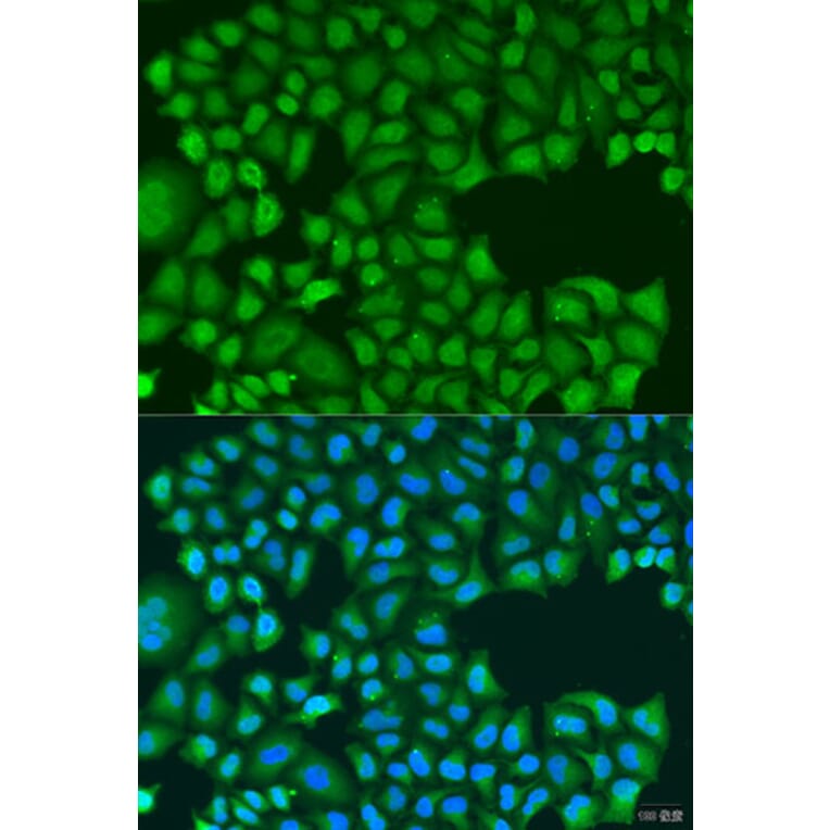 Immunofluorescence - Anti-TIRAP Antibody (A89237) - Antibodies.com