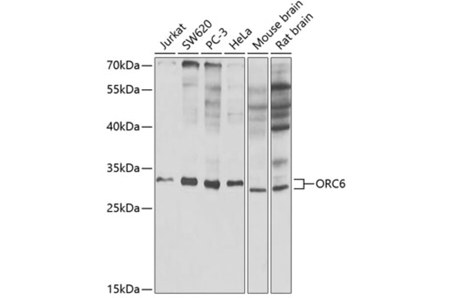 Western Blot - Anti-ORC6 Antibody (A89238) - Antibodies.com