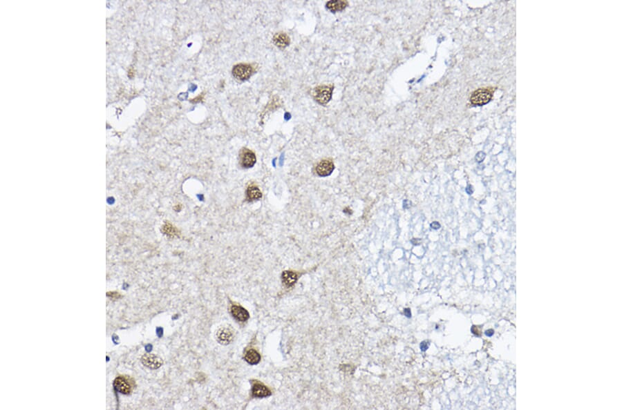 Immunohistochemistry - Anti-ORC6 Antibody (A89238) - Antibodies.com
