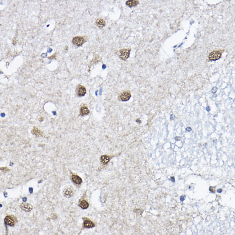 Immunohistochemistry - Anti-ORC6 Antibody (A89238) - Antibodies.com