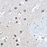 Immunohistochemistry - Anti-ORC6 Antibody (A89238) - Antibodies.com