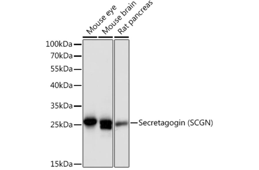 Western Blot - Anti-SCGN/Secretagogin Antibody (A89239) - Antibodies.com