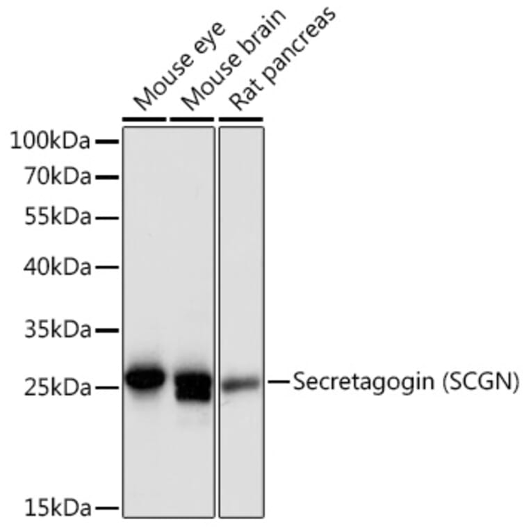 Western Blot - Anti-SCGN/Secretagogin Antibody (A89239) - Antibodies.com