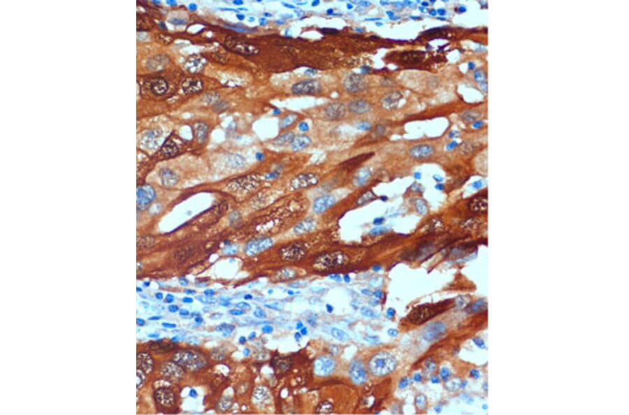 Immunohistochemistry - Anti-SCGN/Secretagogin Antibody (A89239) - Antibodies.com