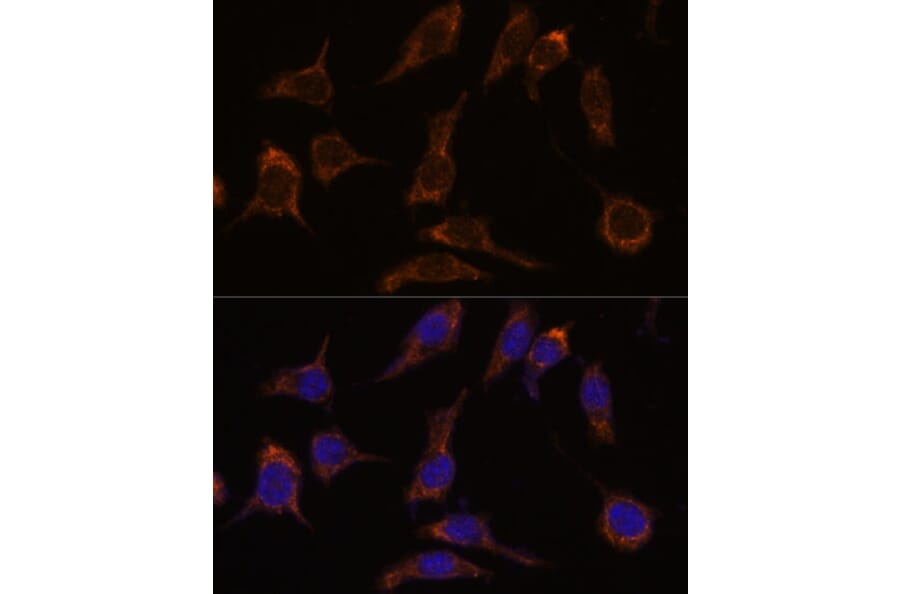 Immunofluorescence - Anti-SCGN/Secretagogin Antibody (A89239) - Antibodies.com