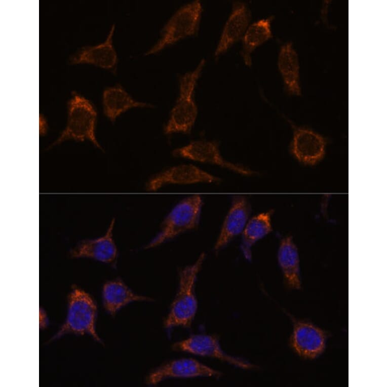 Immunofluorescence - Anti-SCGN/Secretagogin Antibody (A89239) - Antibodies.com