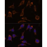 Immunofluorescence - Anti-SCGN/Secretagogin Antibody (A89239) - Antibodies.com