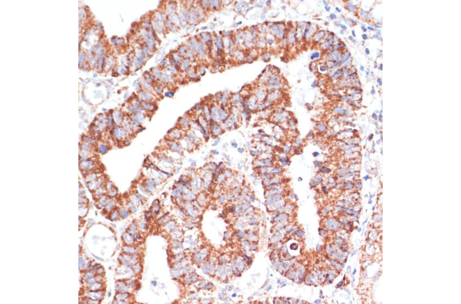Immunohistochemistry - Anti-MRPL46 Antibody (A89240) - Antibodies.com