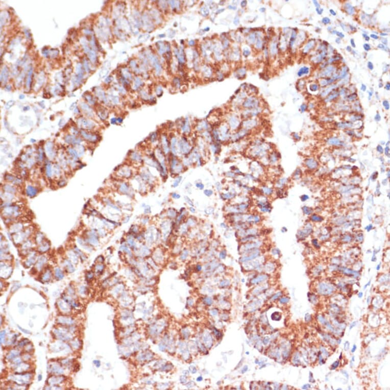 Immunohistochemistry - Anti-MRPL46 Antibody (A89240) - Antibodies.com