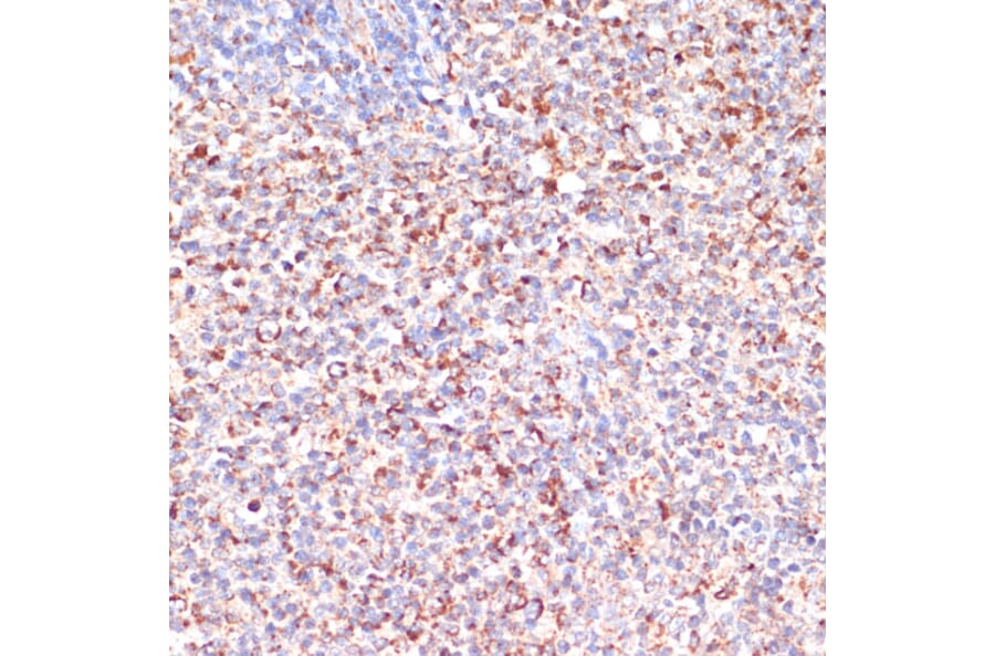 Immunohistochemistry - Anti-MRPL46 Antibody (A89240) - Antibodies.com
