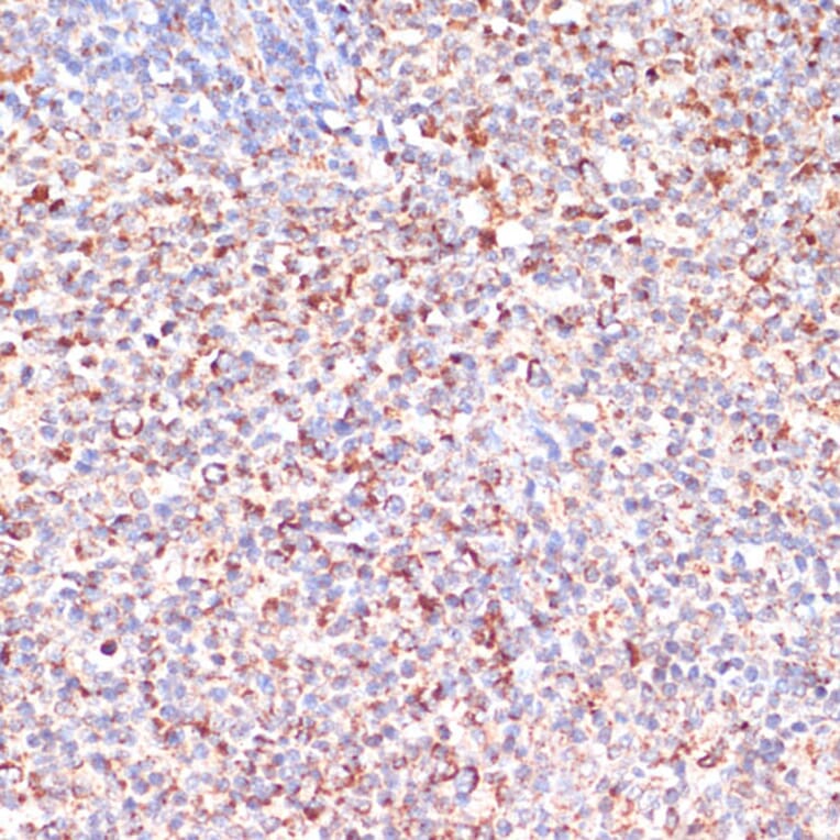 Immunohistochemistry - Anti-MRPL46 Antibody (A89240) - Antibodies.com