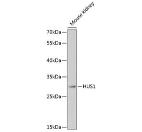 Western Blot - Anti-HUS1 Antibody (A89241) - Antibodies.com