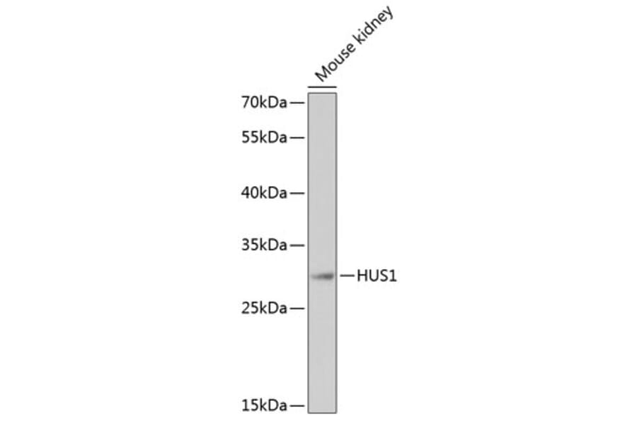Western Blot - Anti-HUS1 Antibody (A89241) - Antibodies.com
