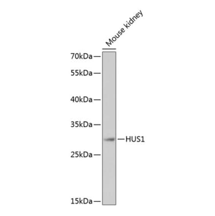 Western Blot - Anti-HUS1 Antibody (A89241) - Antibodies.com