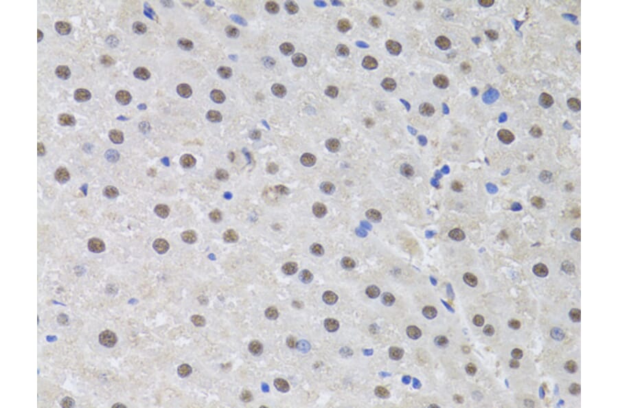 Immunohistochemistry - Anti-HUS1 Antibody (A89241) - Antibodies.com