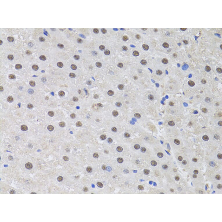 Immunohistochemistry - Anti-HUS1 Antibody (A89241) - Antibodies.com