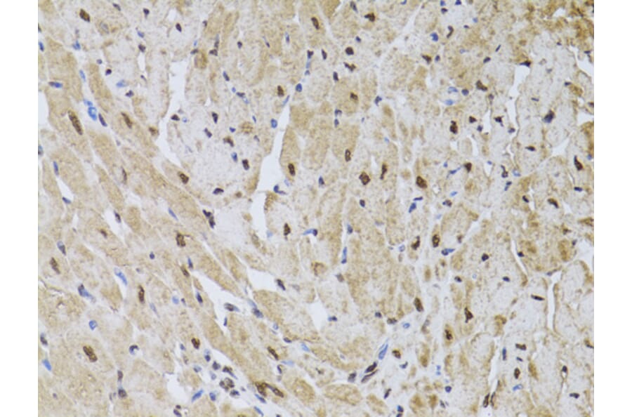 Immunohistochemistry - Anti-HUS1 Antibody (A89241) - Antibodies.com