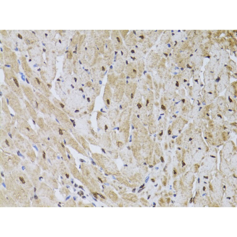 Immunohistochemistry - Anti-HUS1 Antibody (A89241) - Antibodies.com