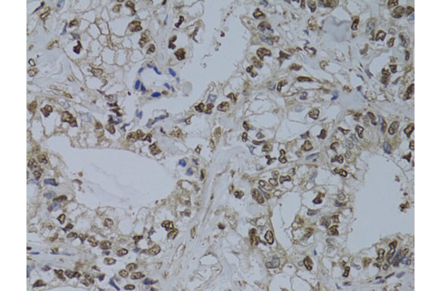 Immunohistochemistry - Anti-HUS1 Antibody (A89241) - Antibodies.com