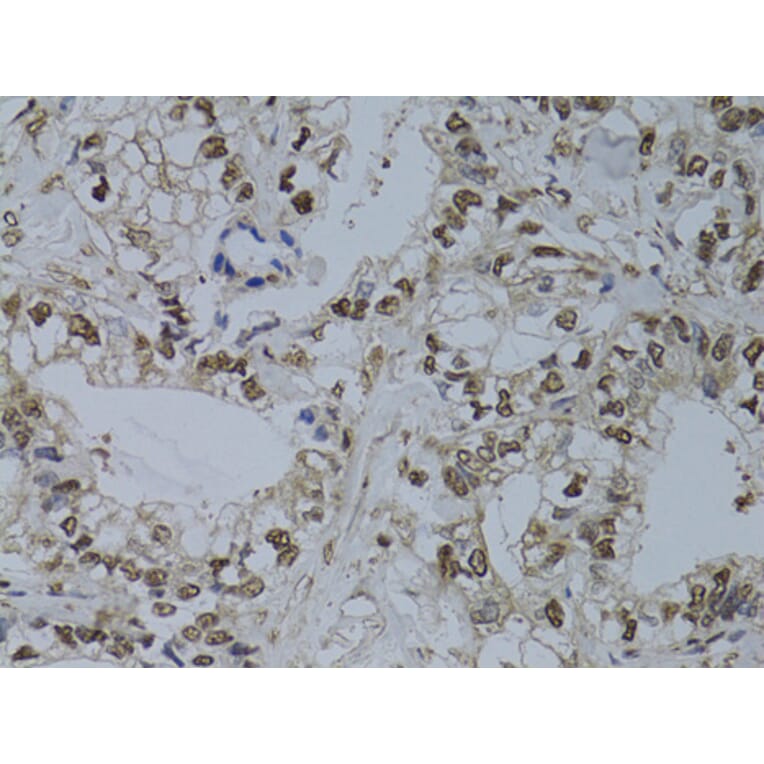 Immunohistochemistry - Anti-HUS1 Antibody (A89241) - Antibodies.com